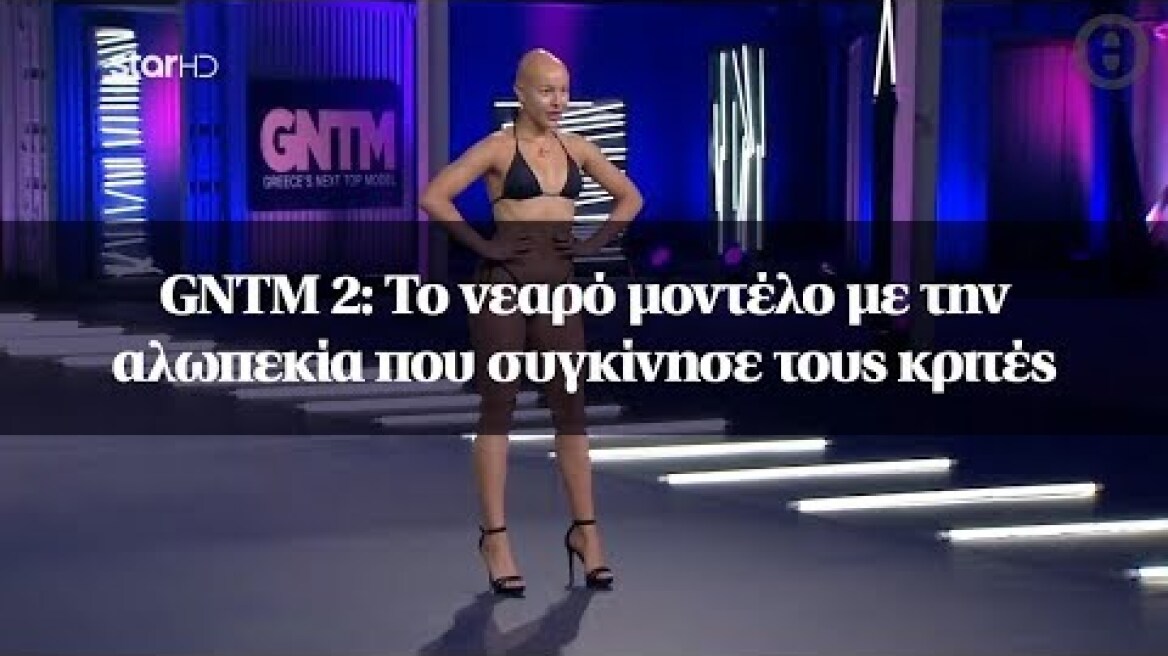 GNTM 2: To νεαρό μοντέλο με την αλωπεκία που συγκίνησε τους κριτές