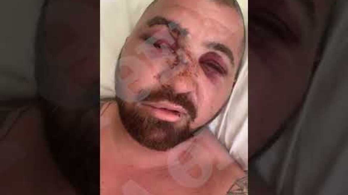 Έλληνας σωματοφύλακας μιλάει στο protothema.gr