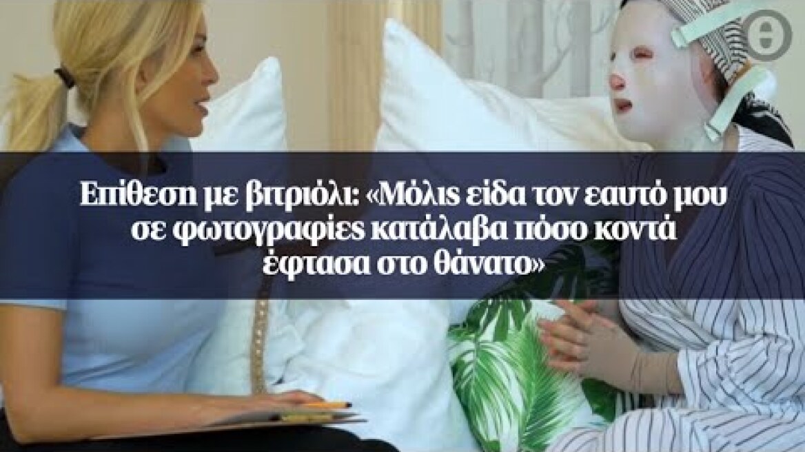 Επίθεση με βιτριόλι: «Μόλις είδα τον εαυτό μου σε φωτογραφίες κατάλαβα πόσο κοντά έφτασα στο θάνατο»