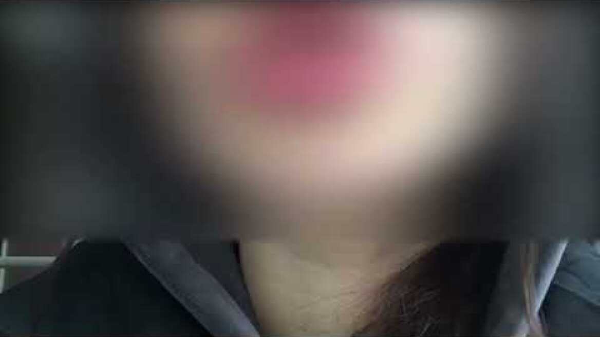 Μαρτυρία από το συμβάν στην Κυψέλη (2)