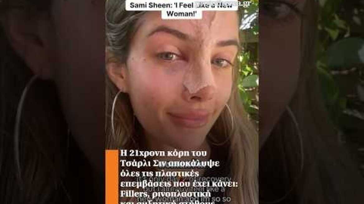 Η 21χρονη κόρη του Τσάρλι Σιν αποκάλυψε όλες τις πλαστικές επεμβάσεις που έχει κάνει