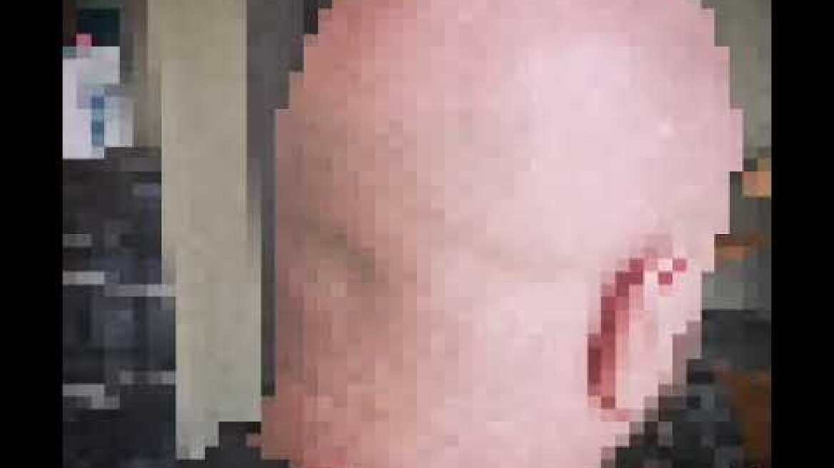 Μαρτυρία για τον Παλαιστίνιο που κυνηγούσε κόσμο με τα ψαλίδια χθες βράδυ στην πλατεία Βάθη