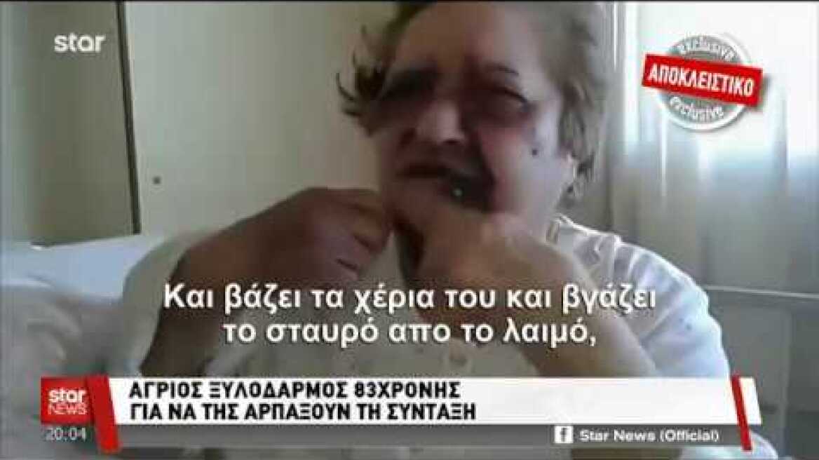 ΑΠΟΚΛΕΙΣΤΙΚΟ: Άγριος ξυλοδαρμός 83χρονης για να της αρπάξουν τη σύνταξη - (STAR 2.4.2018)