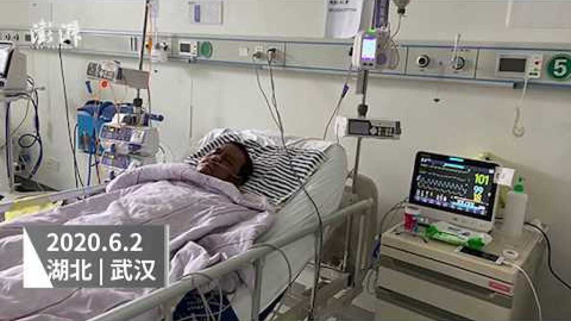 Wuhan doctor whose face turned black during COVID19 treatment died after months of struggle