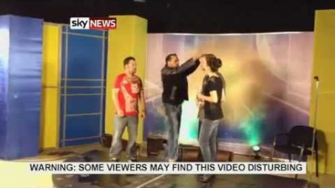 Magician's Head Set On Fire In TV Prank