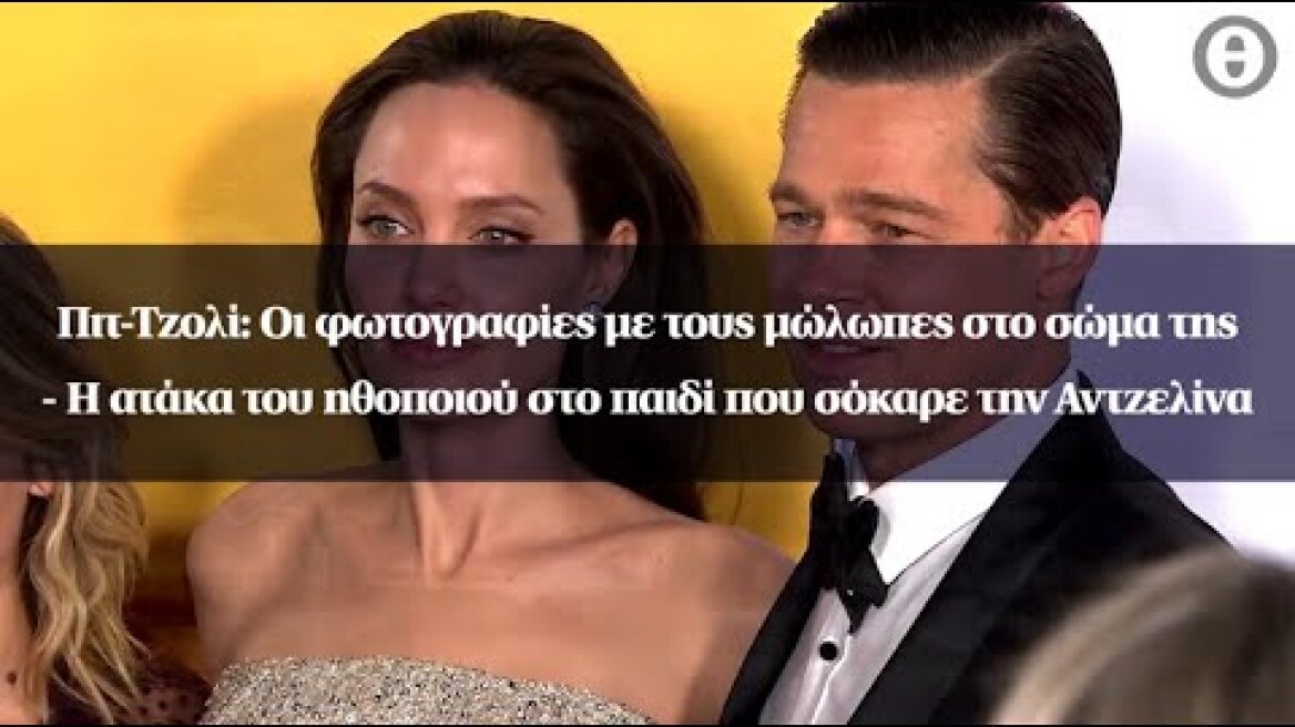 Πιτ-Τζολί: Οι φωτογραφίες με τους μώλωπες στο σώμα της - Η ατάκα του ηθοποιού στο παιδί