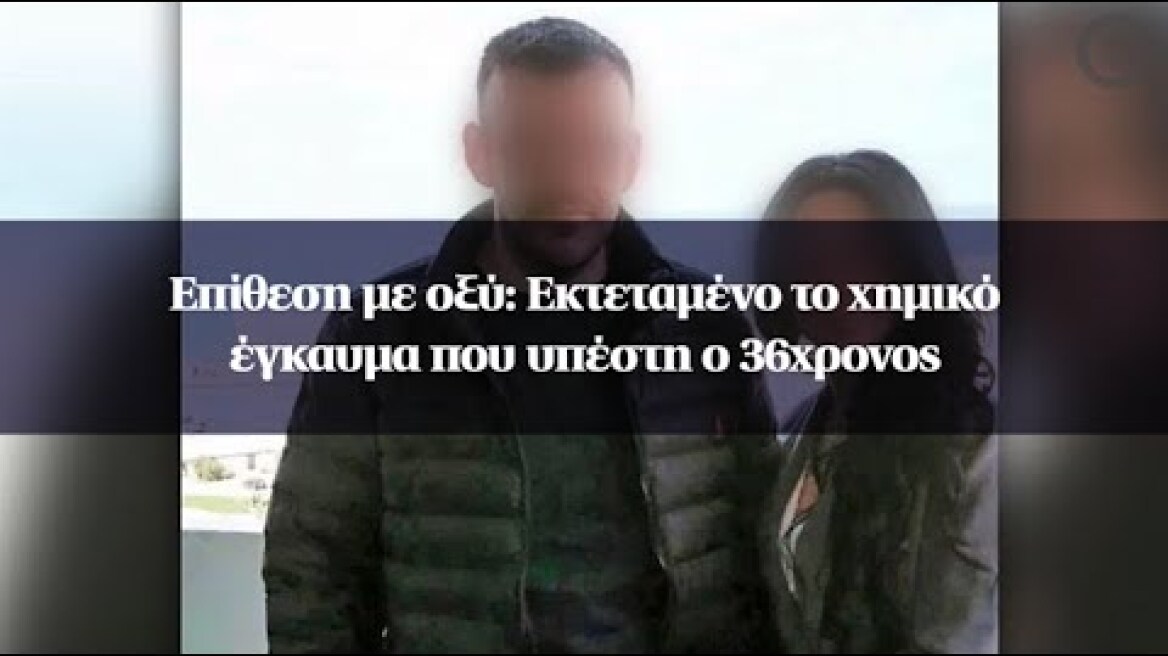 Επίθεση με οξύ: Εκτεταμένο το χημικό έγκαυμα που υπέστη ο 36χρονος