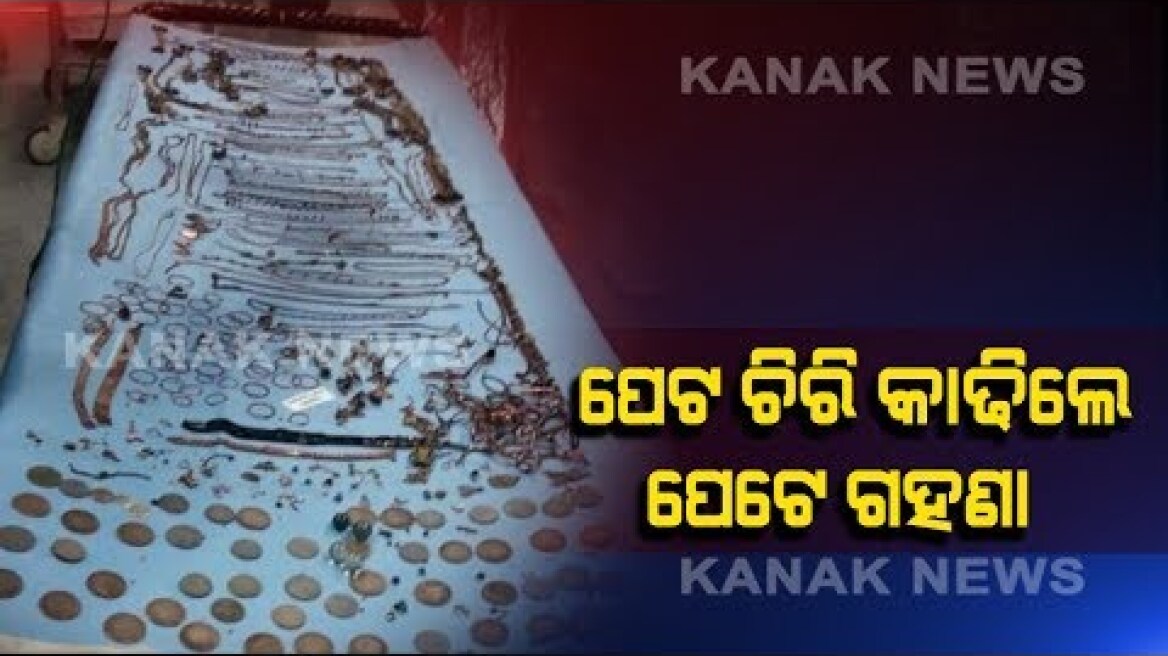 1 5 kg jewellery and coins removed from woman's stomach in Bengal