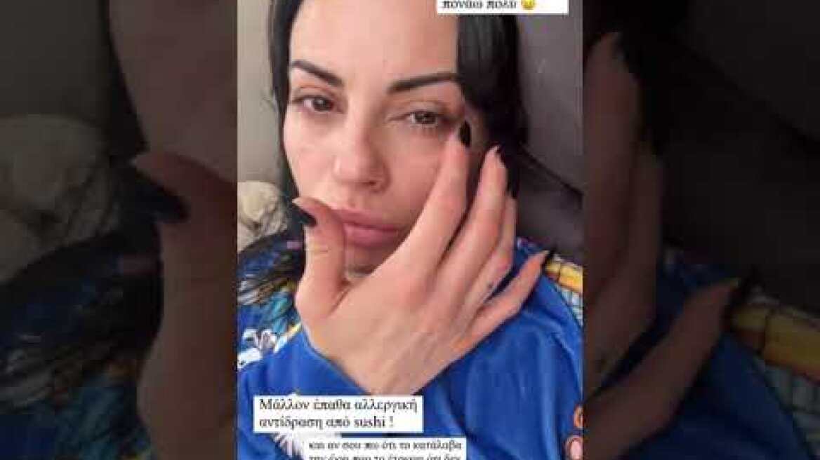 Η Δήμητρα Αλεξανδράκη έπαθε αλλεργική αντίδραση από sushi - Πρήστηκε το πρόσωπό της