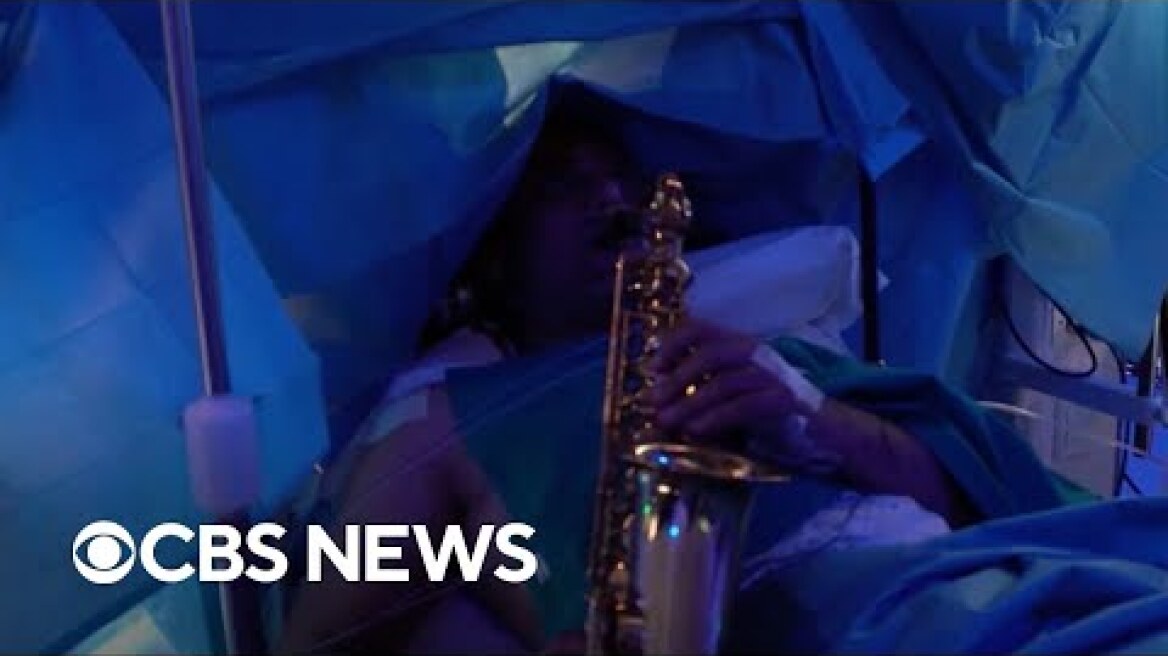 Man plays saxophone during surgery as doctors remove brain tumor