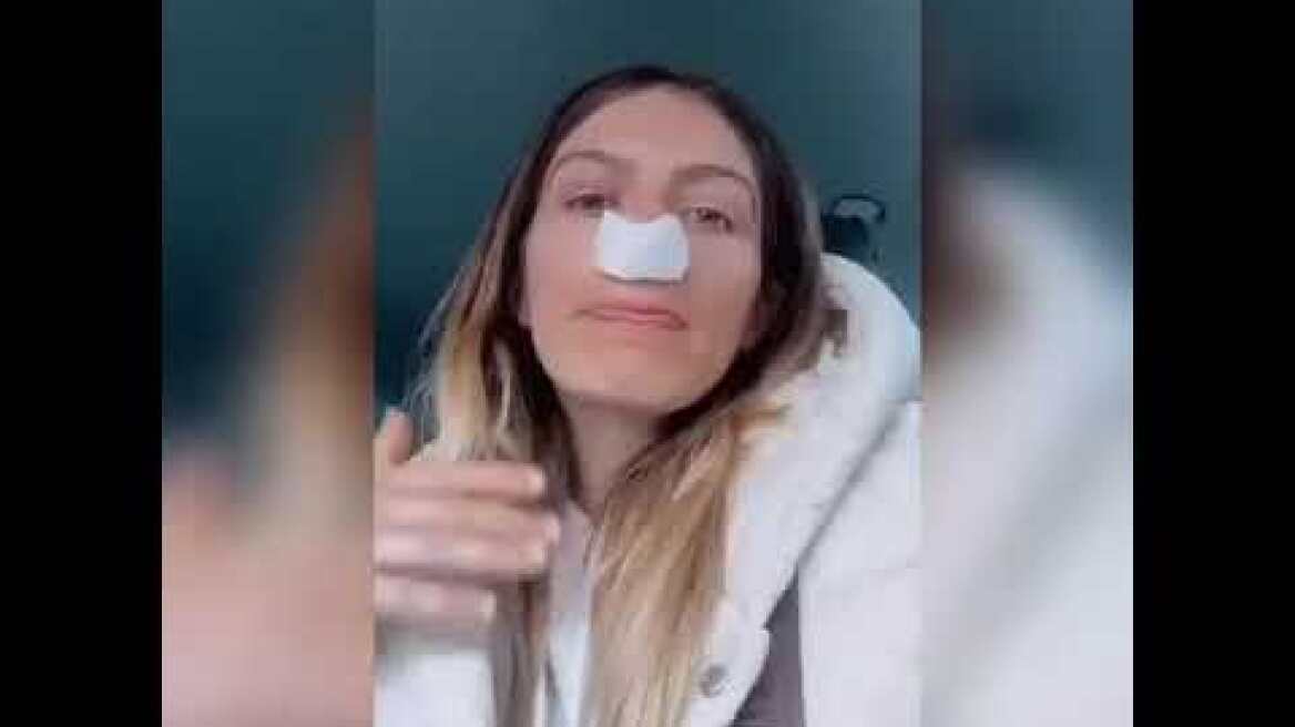 Η Ασημίνα Ουστάλλι για τη μύτη της