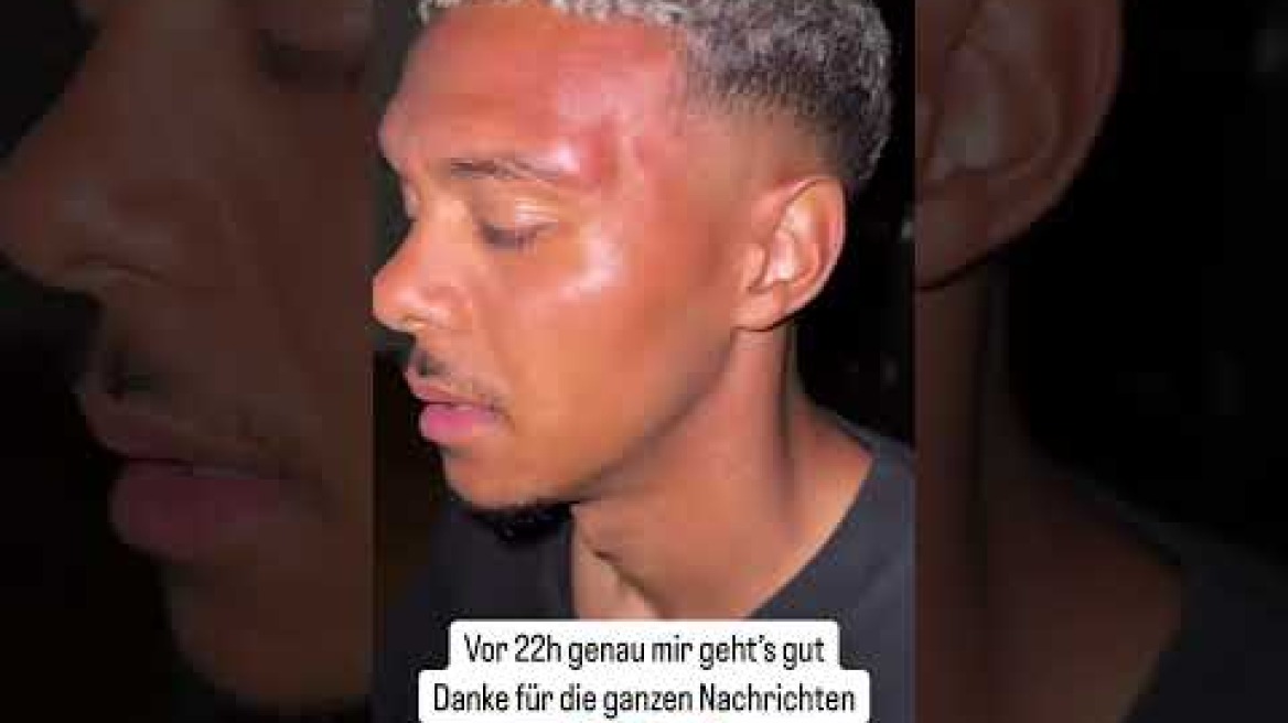 Ο Niklas-Wilson Sommer ξυλοκοπήθηκε από οπαδούς της ομάδας του