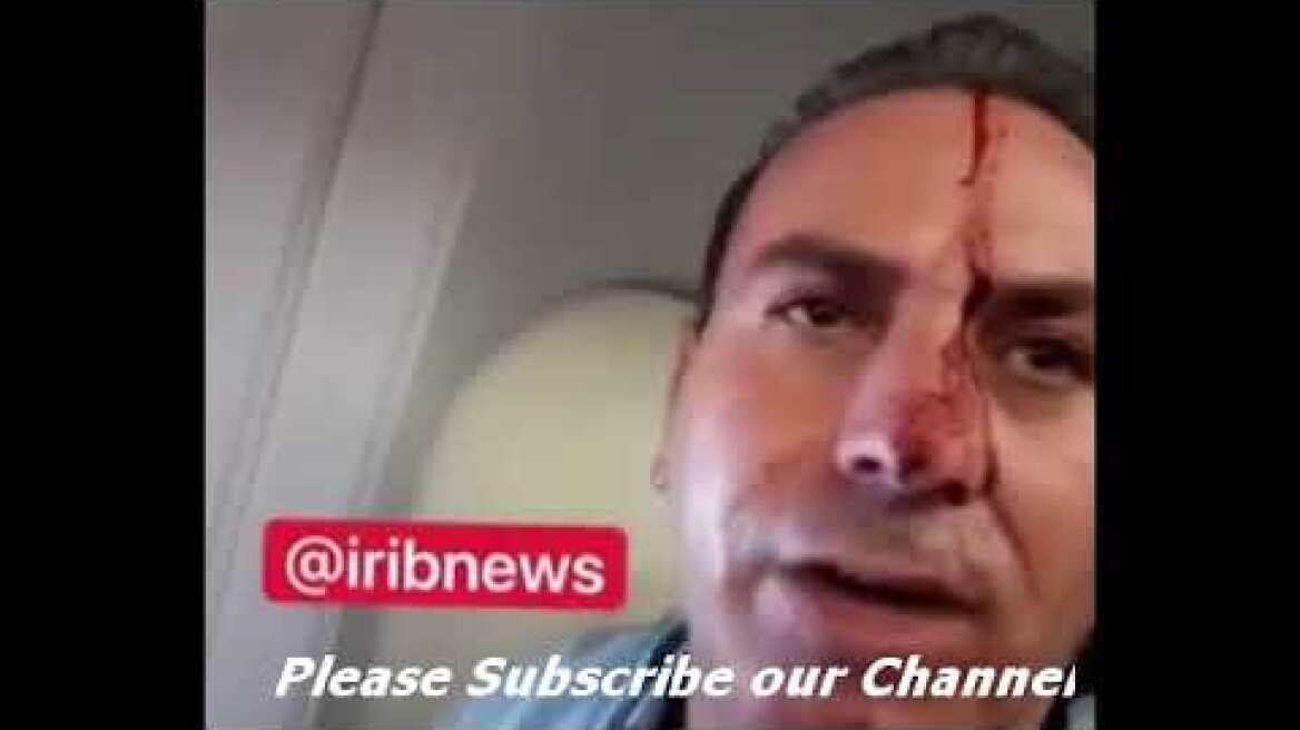 Bloodied Iranian plane passengers as US fighter jet seen close by