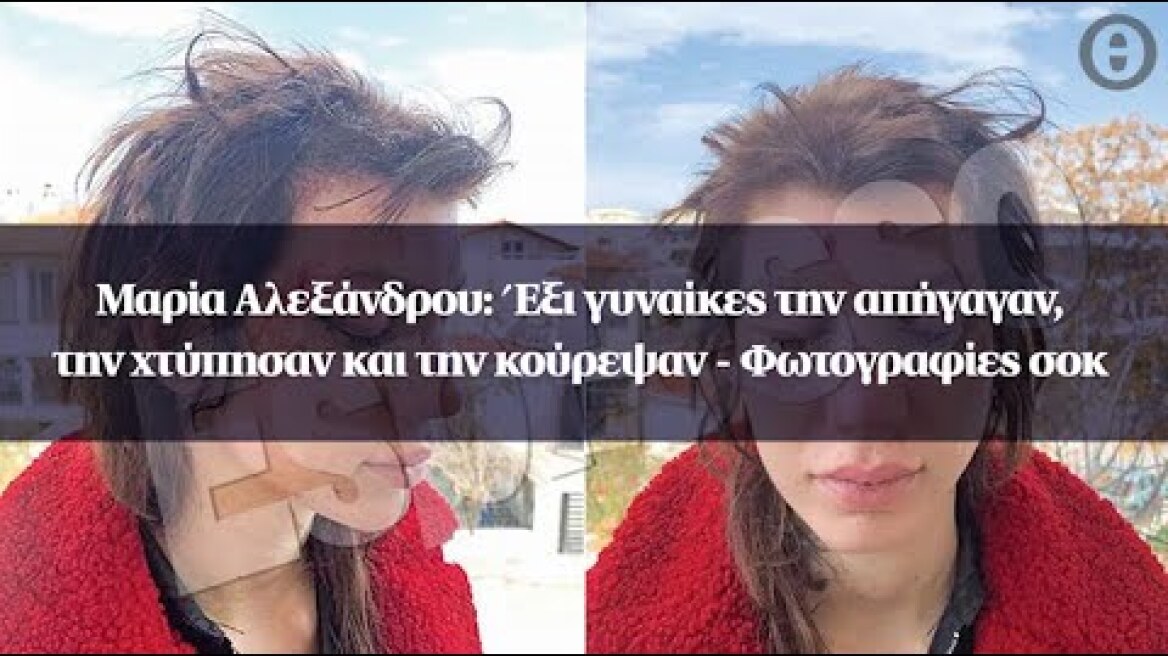 Μαρία Αλεξάνδρου: Έξι γυναίκες την απήγαγαν, την χτύπησαν και την κούρεψαν - Φωτογραφίες σοκ