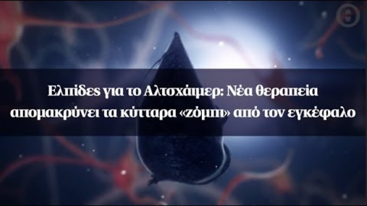 Ελπίδες για το Αλτσχάιμερ: Νέα θεραπεία απομακρύνει τα κύτταρα «ζόμπι» από τον εγκέφαλο