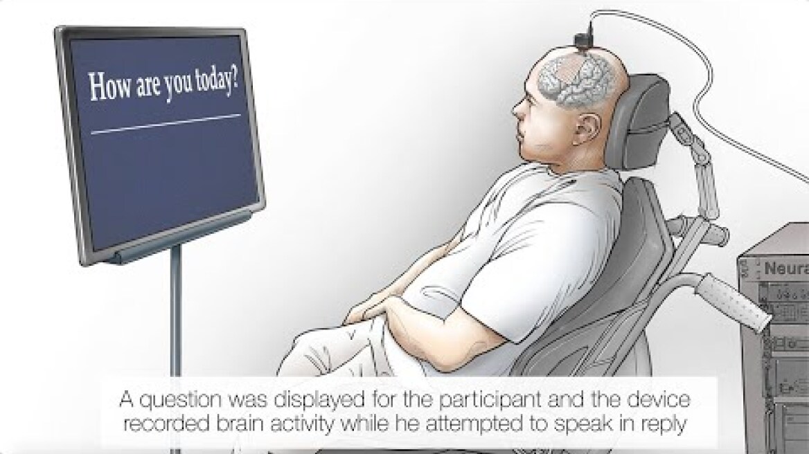 Για πρώτη φορά βουβός μπορεί να «μιλήσει» χάρη στην τεχνητή νοημοσύνη