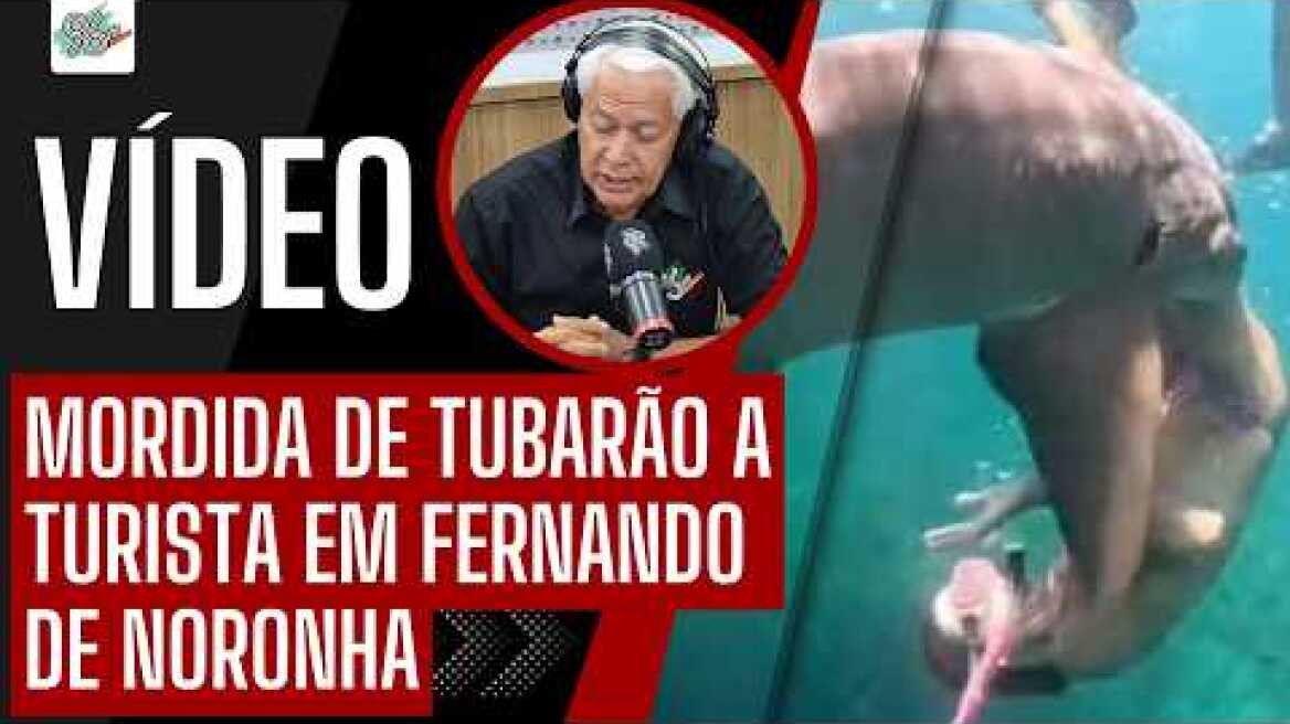 MORDIDA DE TUBARÃO A TURISTA EM FERNANDO DE NORONHA