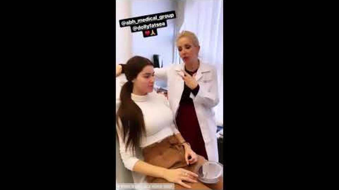 H Ιωάννα Μπέλλα αφαίρεσε το υαλουρονικό από τα χείλη της