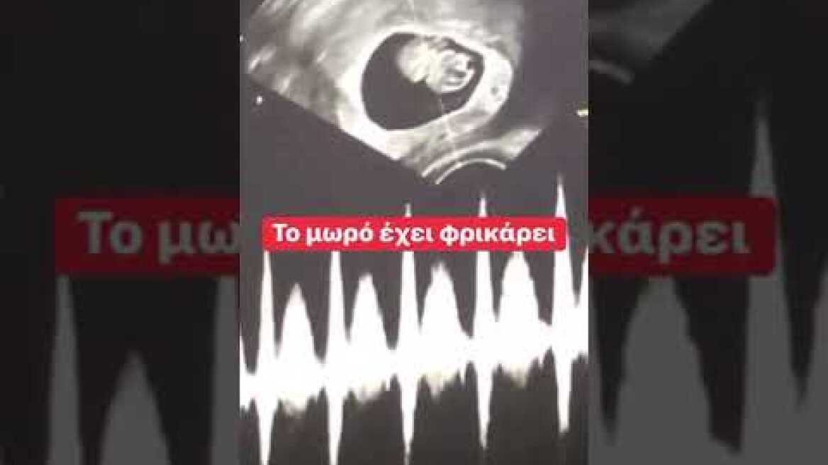 Το μωρό έχει φρικάρει