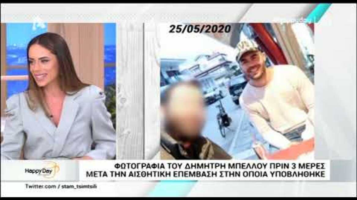 Αυτή είναι η αισθητική παρέμβαση που έκανε ο Δημήτρης Μπέλλος