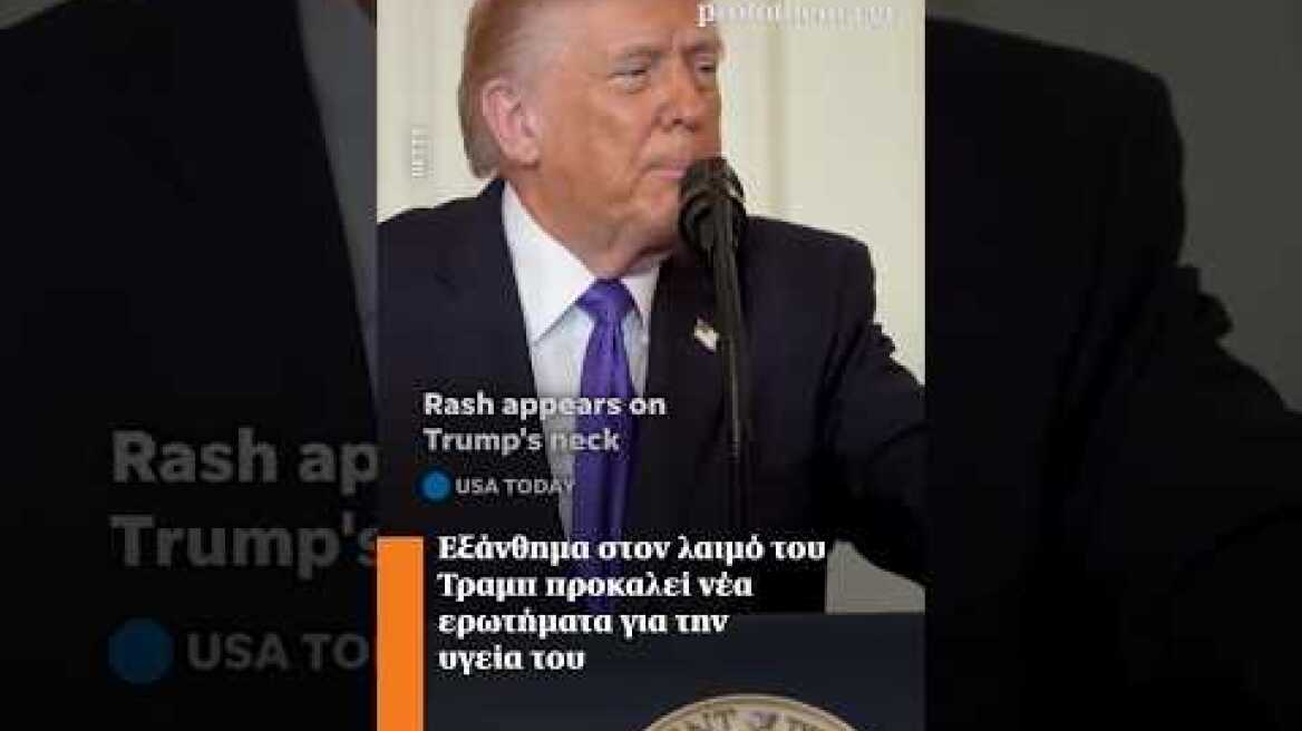 Εξάνθημα στον λαιμό του Τραμπ προκαλεί νέα ερωτήματα για την υγεία του