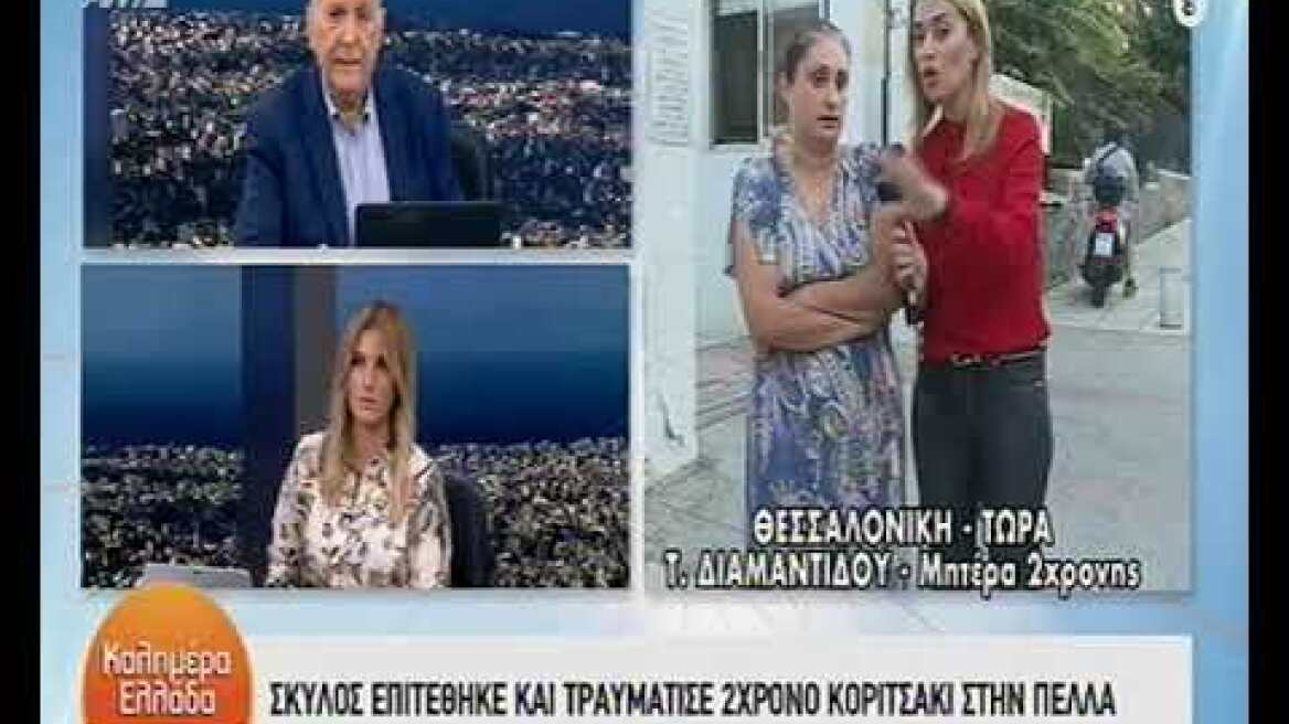 Σκύλος επιτέθηκε σε 2χρονο στην Πέλλα