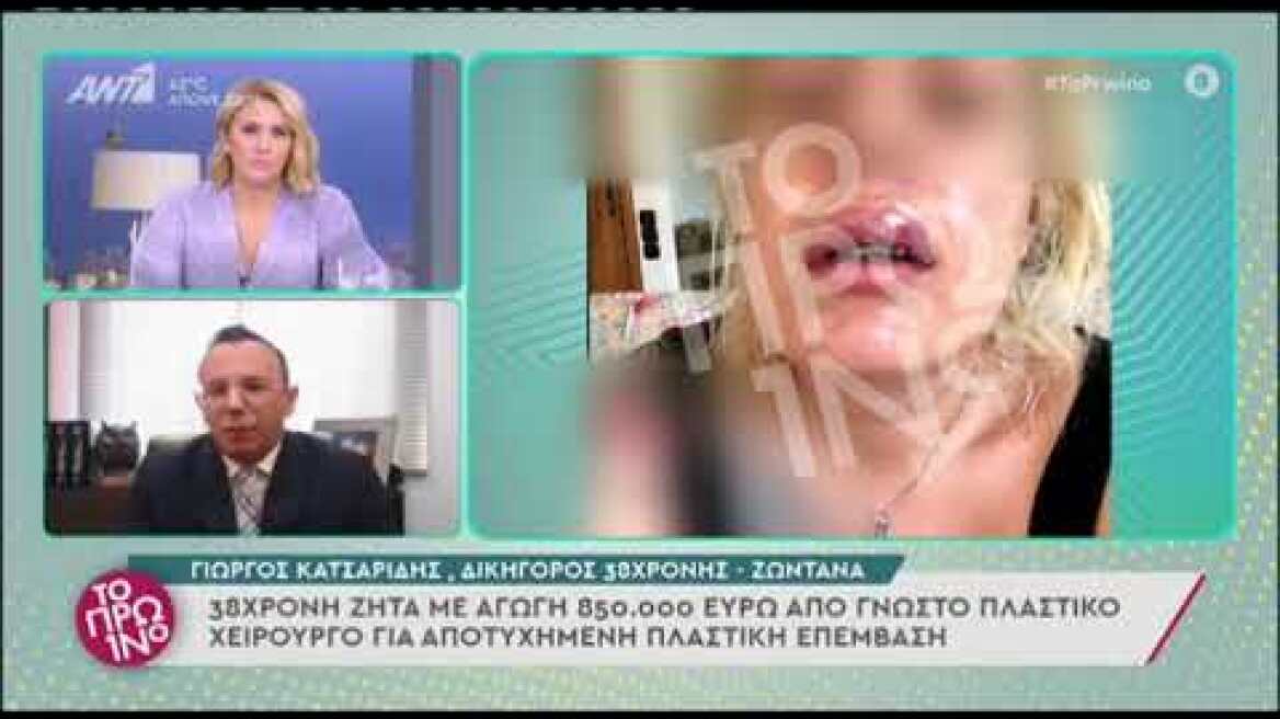 Σοκάρουν οι φωτογραφίες της 38χρονης που καταγγέλλει γνωστό πλαστικό χειρουργό για παραμόρφωση