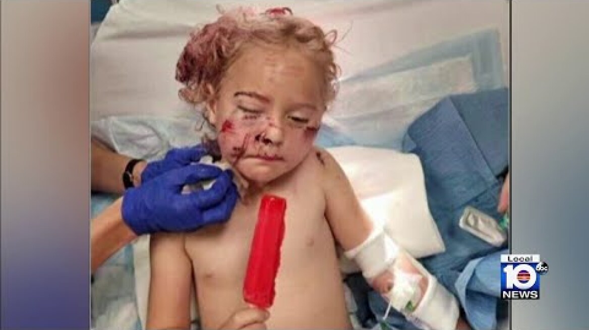 5-year-old hospitalized after dog attack in Fort Lauderdale, family searching for owner