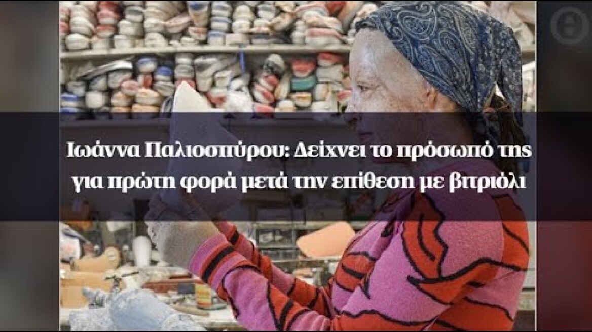 Ιωάννα Παλιοσπύρου: Δείχνει το πρόσωπό της για πρώτη φορά μετά την επίθεση με βιτριόλι