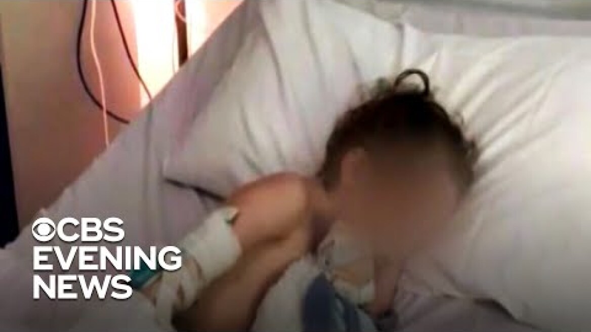 CDC to alert doctors to look for signs of rare, COVID-19-linked inflammatory disease in children