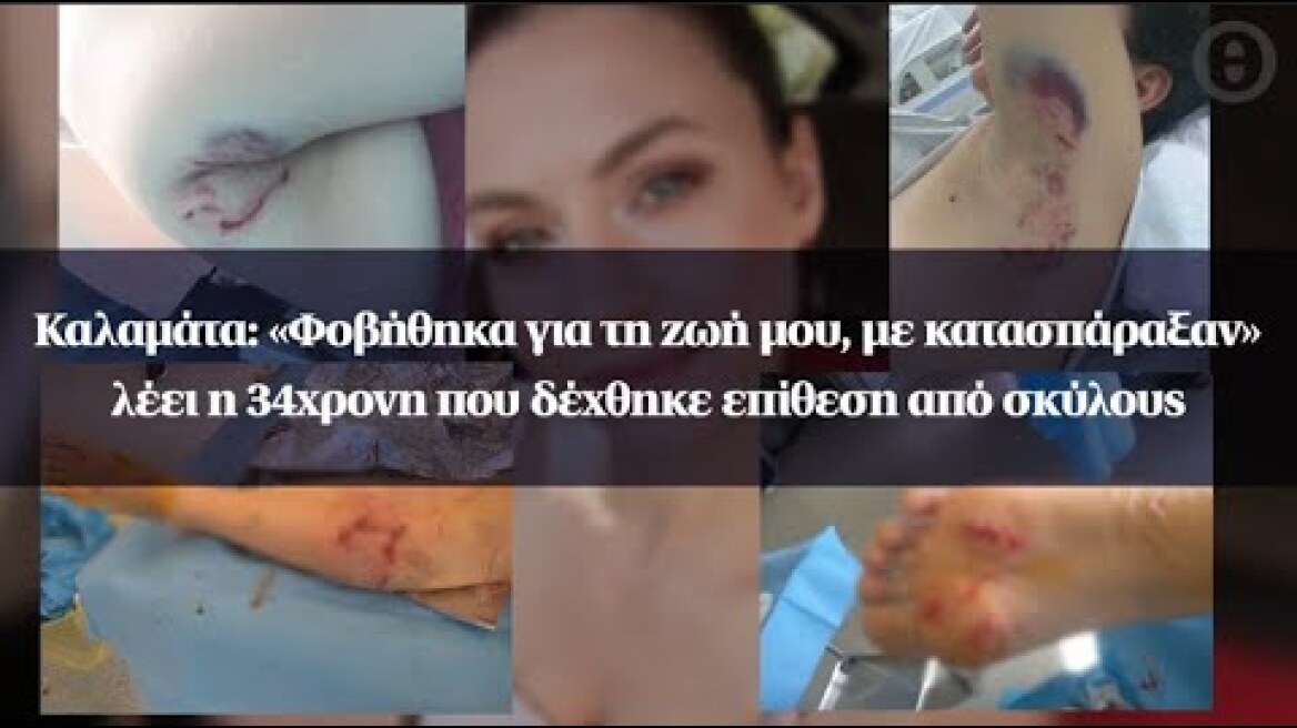 Καλαμάτα: «Φοβήθηκα για τη ζωή μου, με κατασπάραξαν» λέει η 34χρονη που δέχθηκε επίθεση από σκύλους