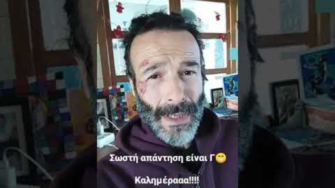 Θανάσης Ευθυμιάδης: Ατύχημα για τον ηθοποιό