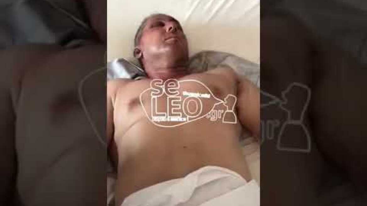 Τι λέει ο σεκιουριτάς που δέχθηκε επίθεση από διαρρήκτες