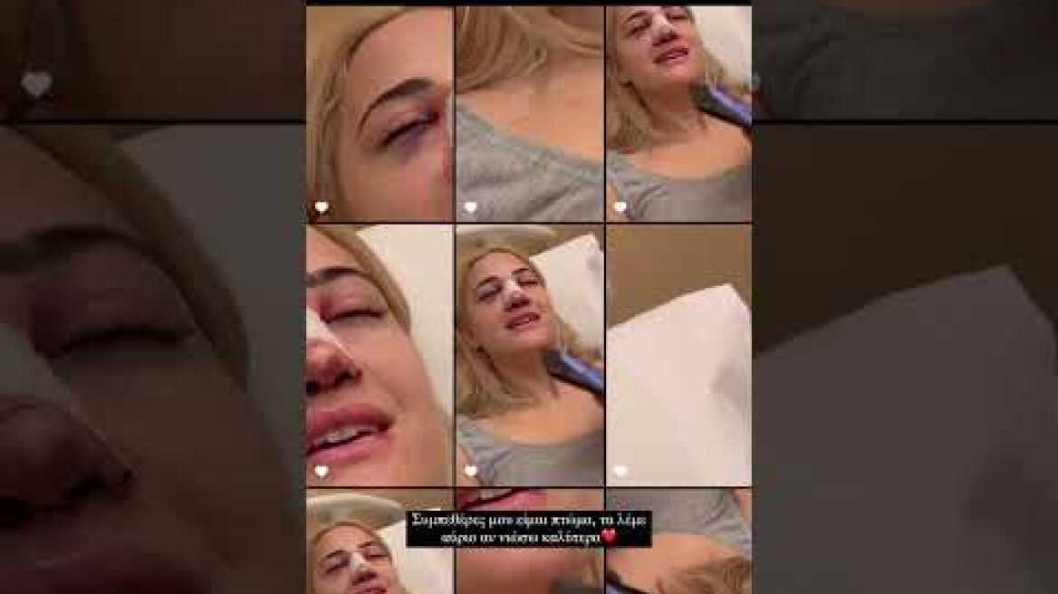 Η Ιωάννα Τούνη έκανε επέμβαση στη μύτη