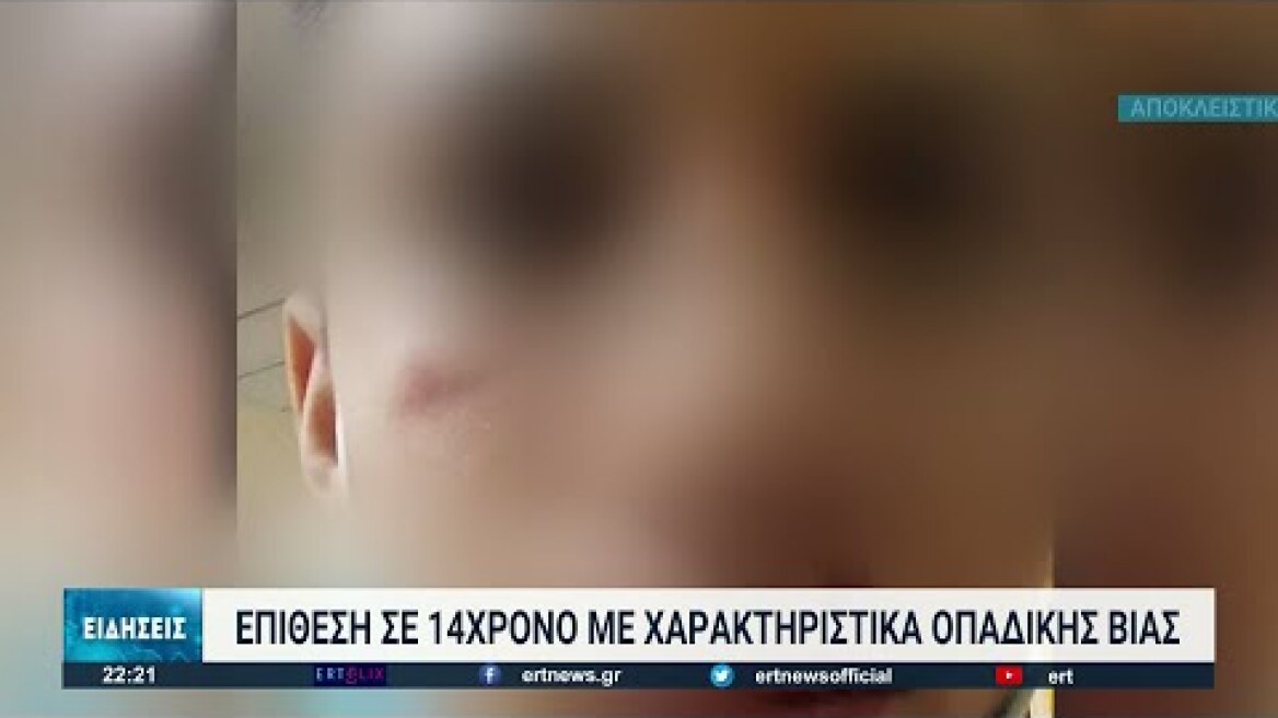 Θεσσαλονίκη: Οπαδική βία και σε 14χρονο!