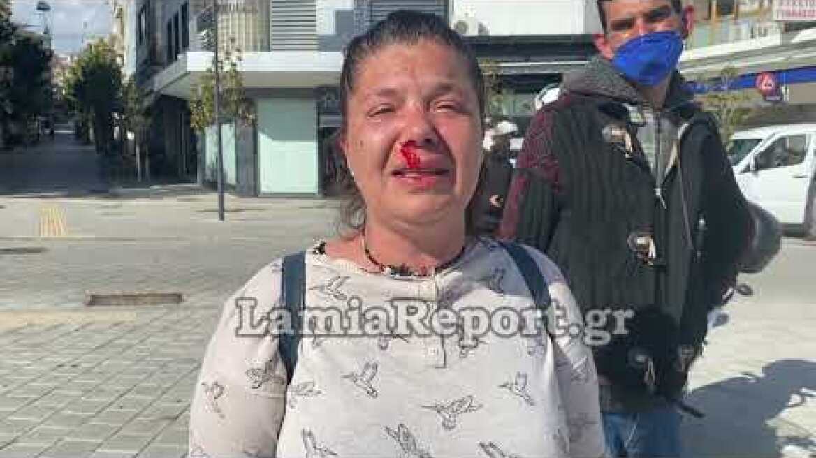 LamiaReport.gr: Τη γρονθοκόπησε μέσα στην πλατεία - Έκκληση  για βοήθεια