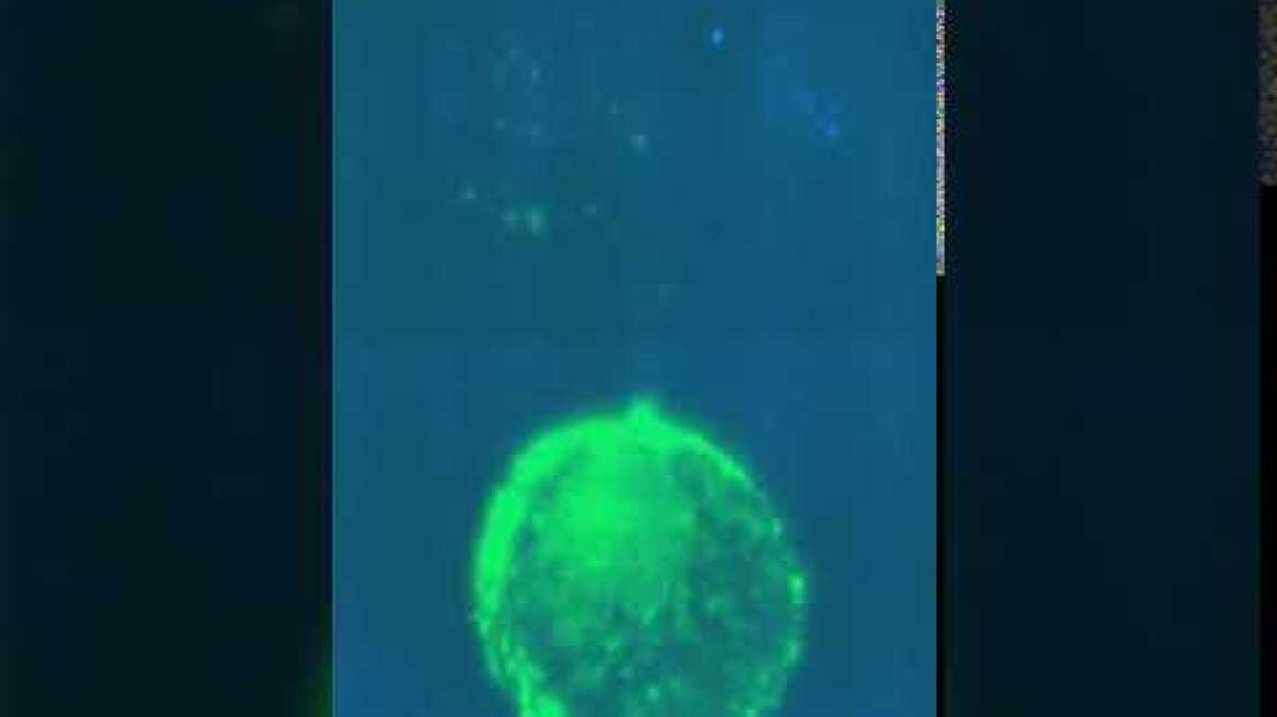 Top View of HIV-Infected Cell in Contact with Epithelium