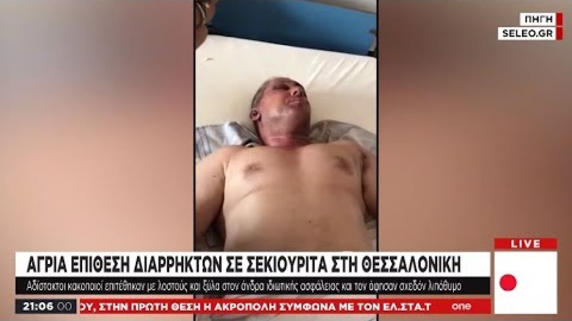 Θεσσαλονίκη: Άγριος ξυλοδαρμός σεκιουριτά από διαρρήκτες – Τι δήλωσε το θύμα