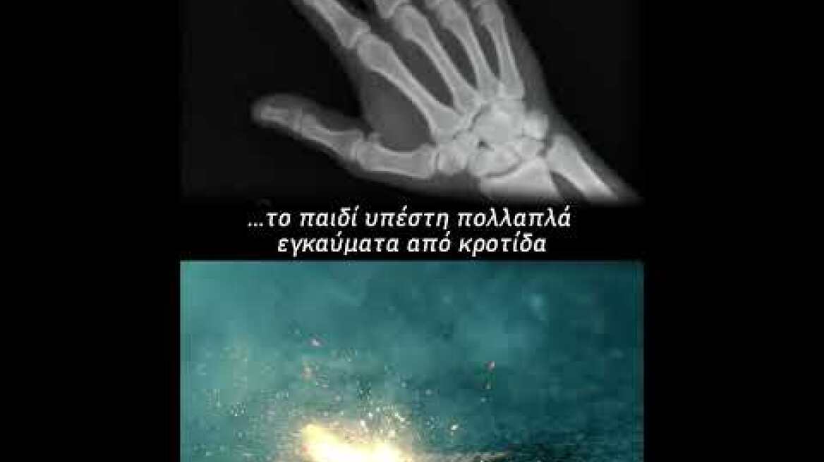 07042026: Βίντεο με θέμα την αποφυγή χρήσης κροτίδων, βεγγαλικών και αυτοσχέδιων ειδών πυροτεχνίας