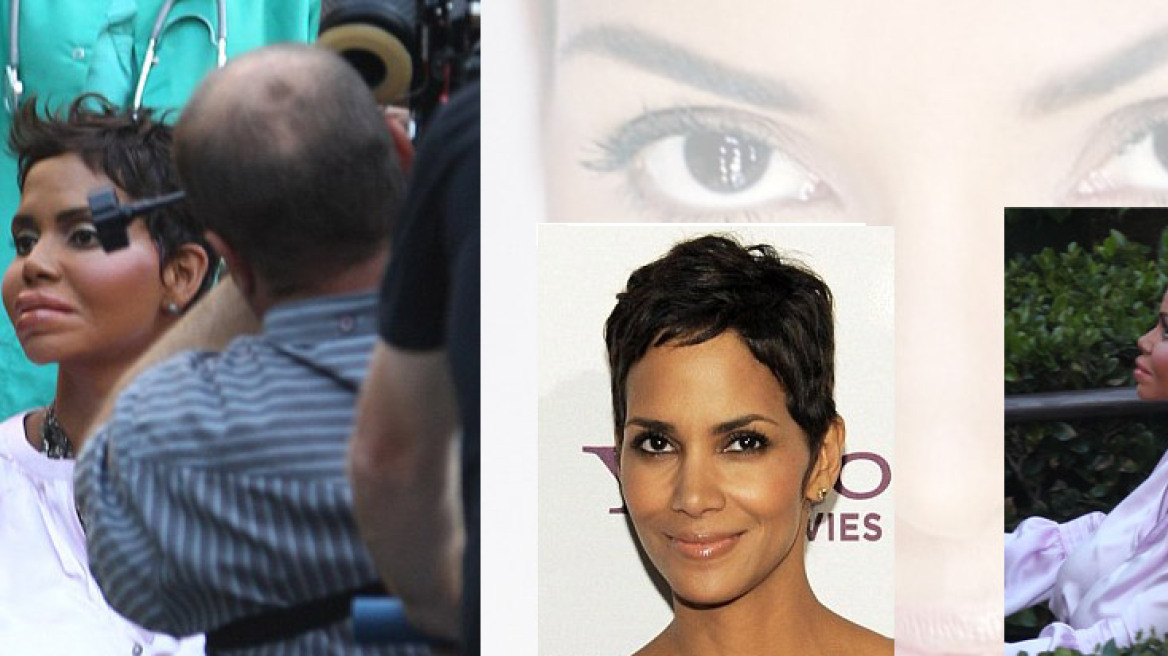 Γιατί πρήστηκε η Halle Berry;