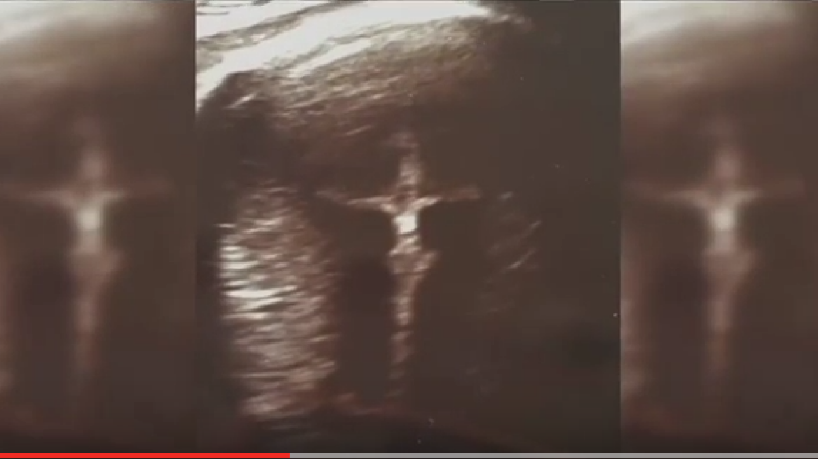 Jesus ‘appears’ in woman’s prenatal sonogram! (video)