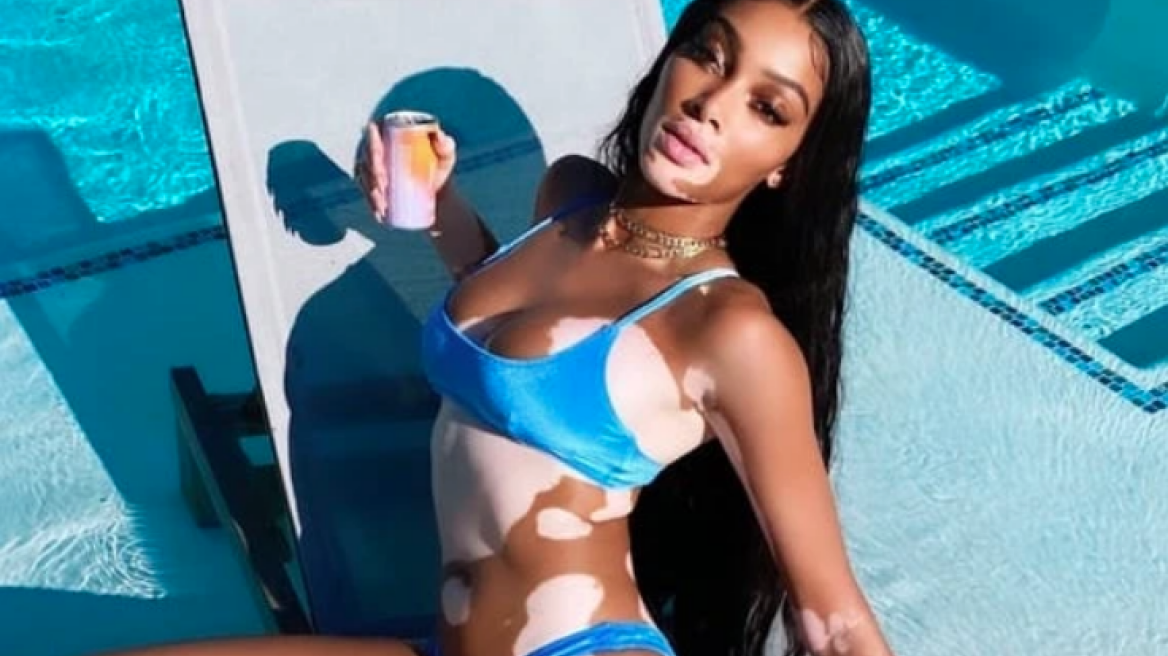 Η Winnie Harlow ποζάρει στην πισίνα με το πιο hot μαγιό της σεζόν