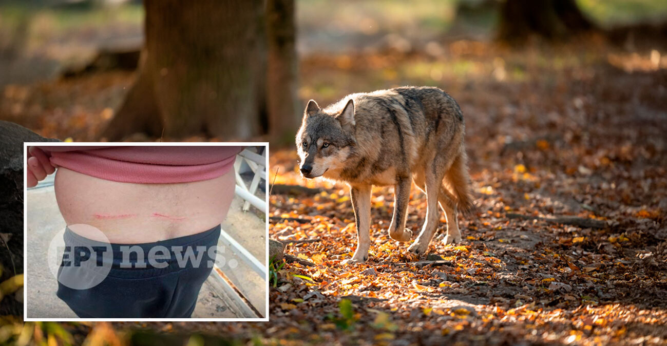 «Μου έσκισε τη μπλούζα και μου έκανε γρατζουνιές»: Πώς σώθηκε ο άνδρας που δέχθηκε επίθεση από λύκο στο Τατόι