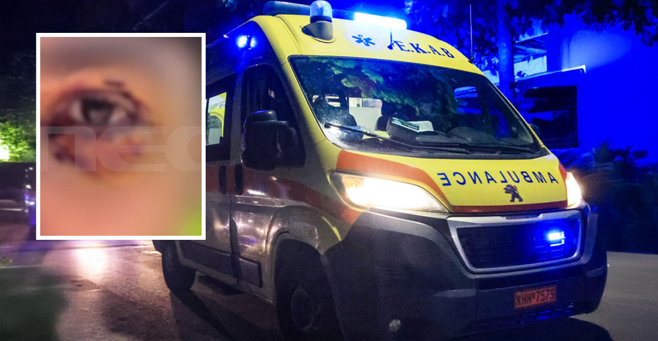 Έστησαν ενέδρα σε 16χρονο στα Ιωάννινα, τον ξυλοκόπησαν και κινδύνευσε να χάσει την όρασή του: Ο δράστης έλεγε «έβλεπα τα αίματα και τρελαινόμουν»