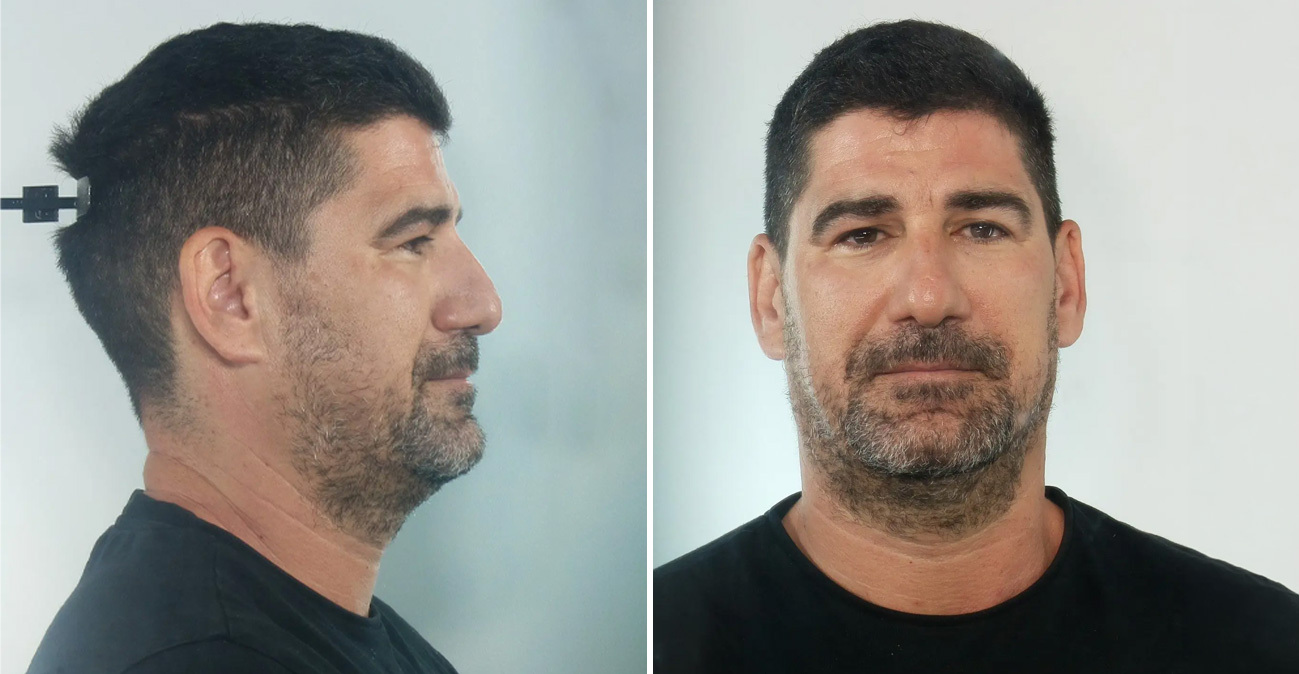 Για βιασμούς ανήλικων αθλητριών κατ’ εξακολούθηση διώκεται ο προπονητής στην Κεφαλονιά, στη δημοσιότητα τα στοιχεία του