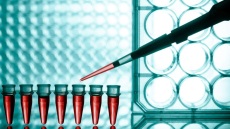 Φινλανδία: Ερευνητές ανέπτυξαν λειτουργικά αιμοφόρα αγγεία