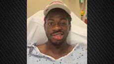 Ο Lil Nas X μεταφέρθηκε εσπευσμένα στο νοσοκομείο - Παρέλυσε το μισό του πρόσωπο