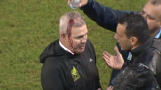 Αγκίρε: Οπαδοί της Ονδούρας άνοιξαν με κονσερβοκούτι το κεφάλι του προπονητή του Μεξικού - Βίντεο 