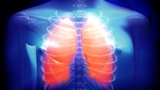 Κυστική Ίνωση: η θανατηφόρος νόσος που μετατρέπεται σταδιακά σε διαχειρίσιμη χρόνια πάθηση