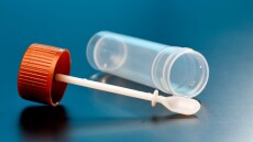 Υπάρχει τρόπος να γλυτώσουμε την κολονοσκόπηση